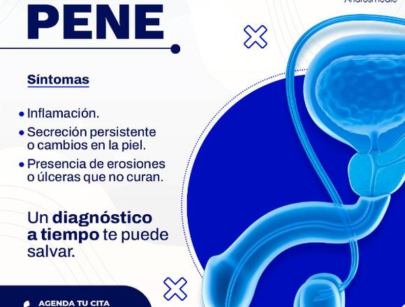 Detecta a tiempo el cáncer de pene 