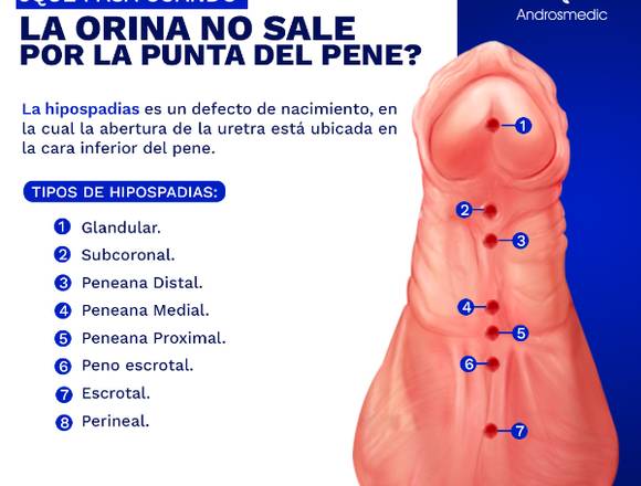 Si la orina no sale por la punta del PENE...