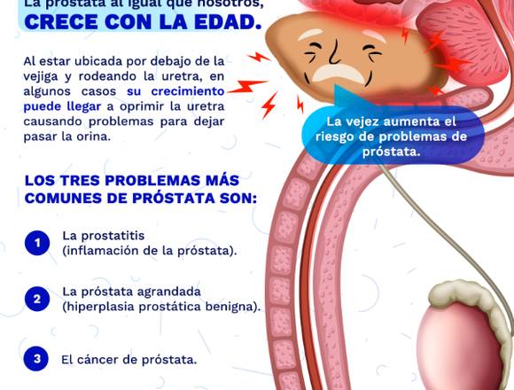 ¿Sufres de problemas de próstata?