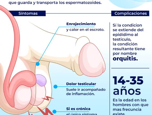 ¿Tienes epididimitis?