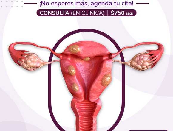 ¿Presenta Miomas Uterinos? 