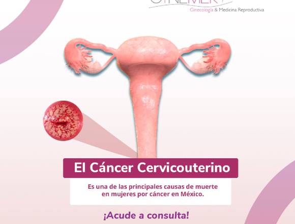 Cáncer Cervicouterino