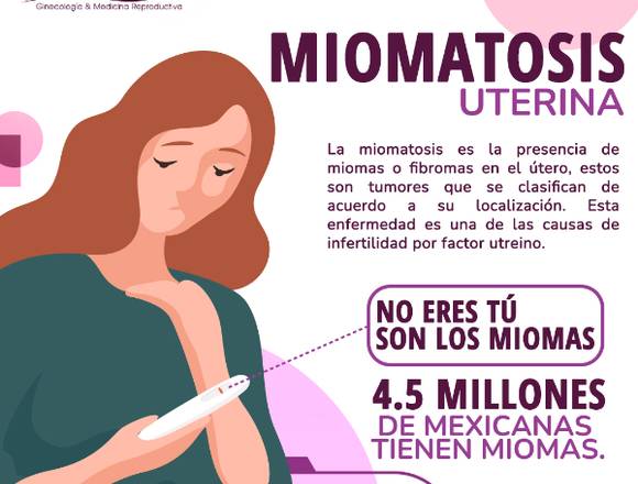 ¿Qué es miomatosis uterina?