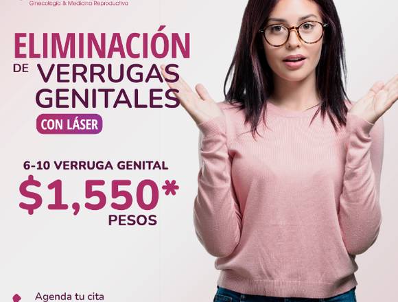 ¿Verrugas por VPH ¡Eliminalas!