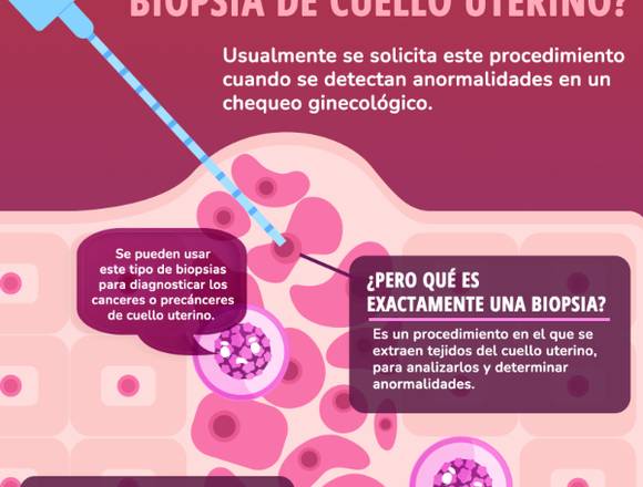 ¿Necesitas una biopisa?