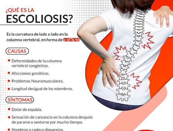 ¿Que es la Escoliosis?