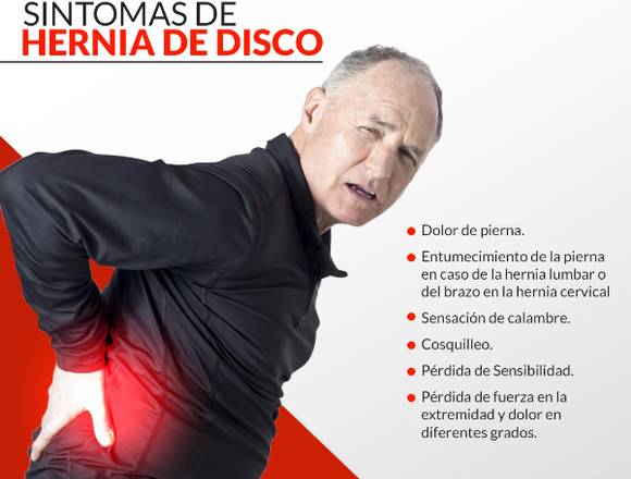 ¿Síntomas de hernia de disco?