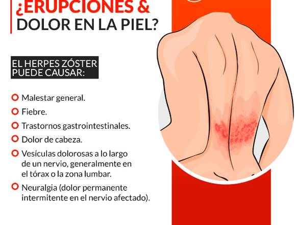 ¿Erupciones y dolor en la piel?