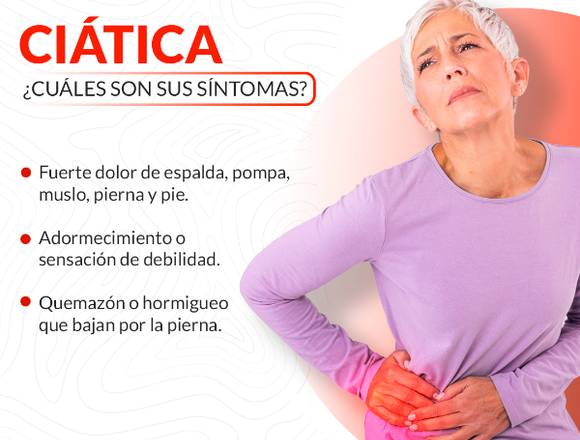 ¿Sufres de dolor de #ciatica?