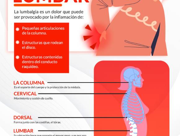 ¿Tienes dolor lumbar?