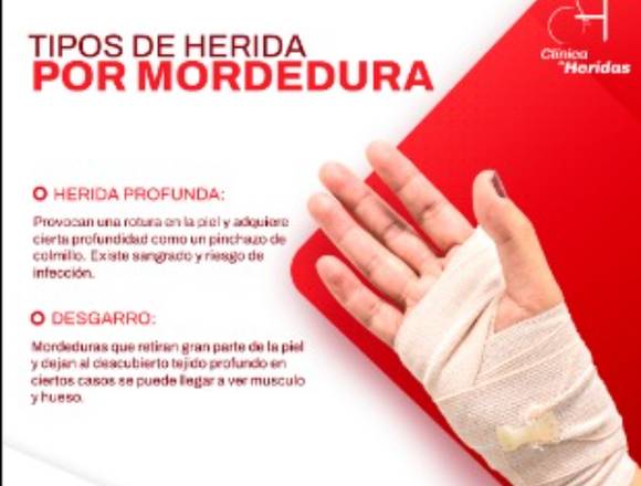 ¿tienes una mordedura?