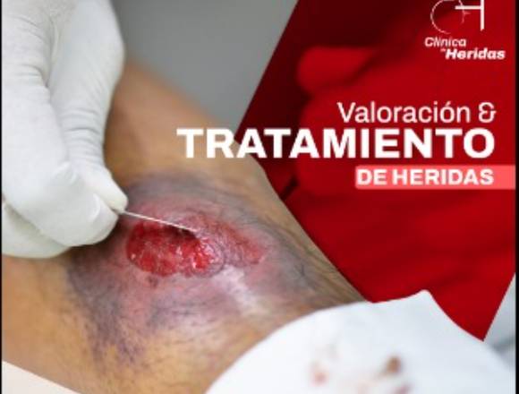 tratamiento para tus heridas