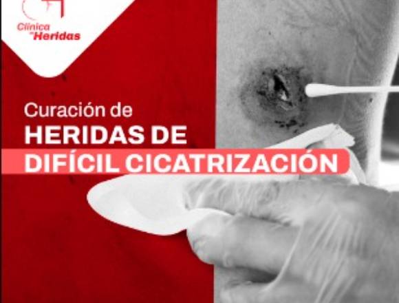 Heridas de difícil cicatrización 