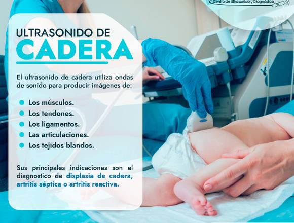 Ultrasonido de cadera 