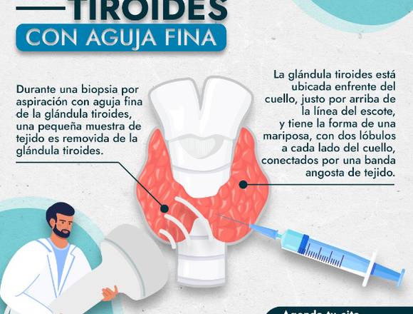 Biopsia de tiroides guiada por ultrasonido 