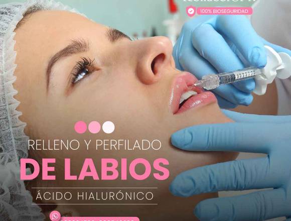 Perfilado De Labios - Ácido Hialurónico