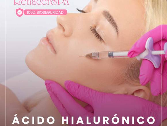 Ácido hialurónico - medicina estetica