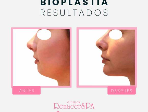 Define tu perfil – Bioplastia 