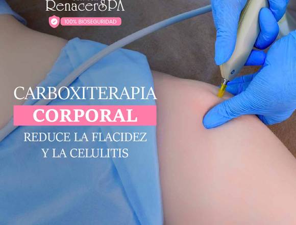 Reduce la flacidez – carboxiterapia