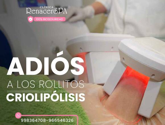 Criolipólisis – Abdomen