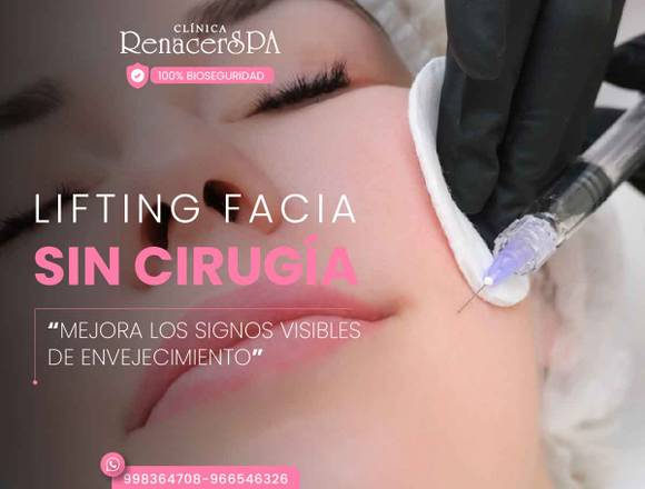 Lifting Facial - cirugia