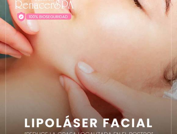 Rostro delgado - Lipolaser facial