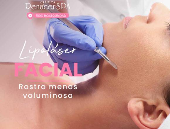 Lipoláser Facial - cirugia