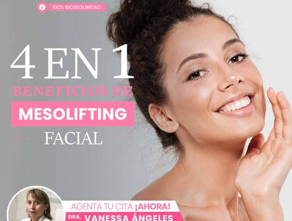 Mesolifting Facial – Rejuvenecimiento facial