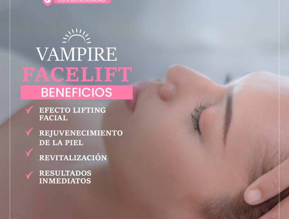 Vampire Facelift - Rejuvenecimiento Facial