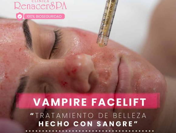 Rostro joven - Vampire Facelift