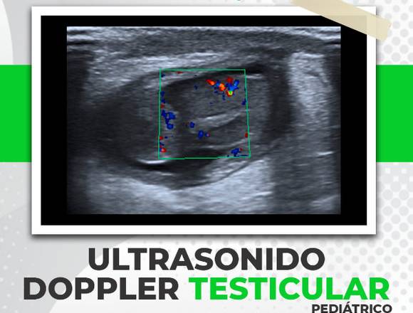 🖥 Ultrasonido Doppler Testicular 👶