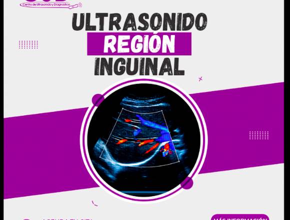 ULTRASONIDO REGIÓN INGUINAL