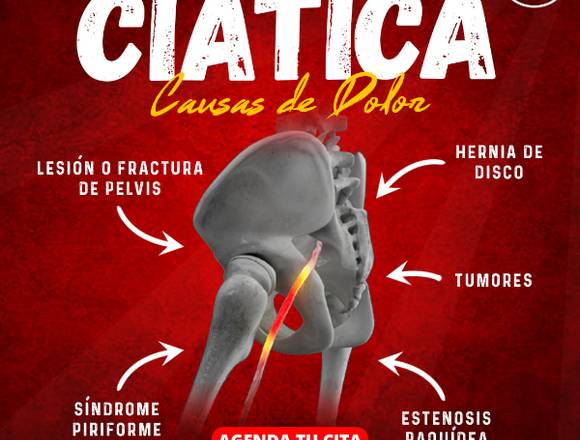 Ciática: Causas de Dolor