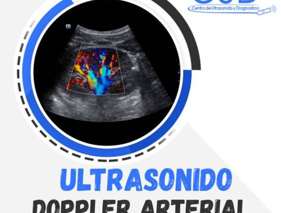 Ultrasonido Doppler Arterial