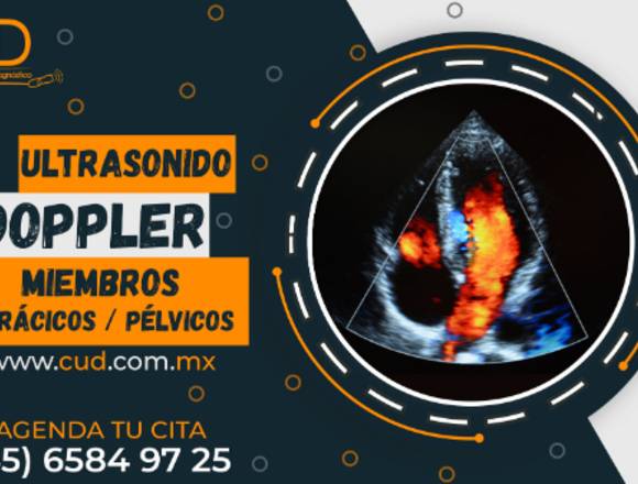 Ultrasonidos Doppler Miembros Torácicos / Pélvicos