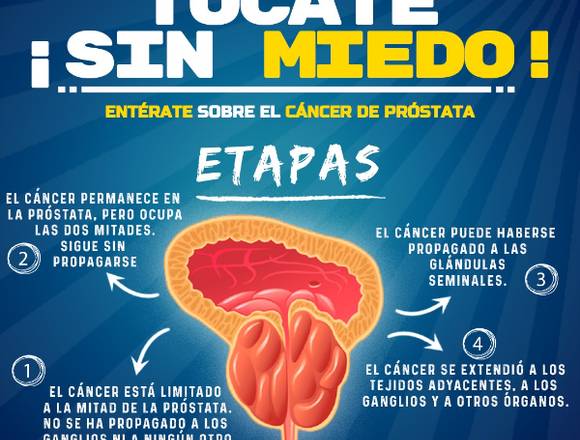 Cáncer de Próstata.-..,,.,--,,