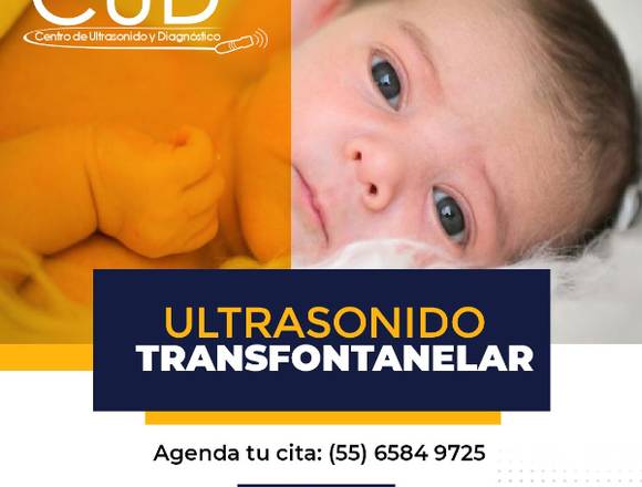 Ultrasonido Transfontanelar