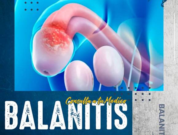 🤒 Balanitis 🍆..........