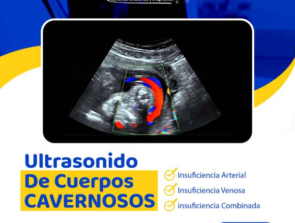 Ultrasonido de Cuerpos Cavernosos ....-..-.