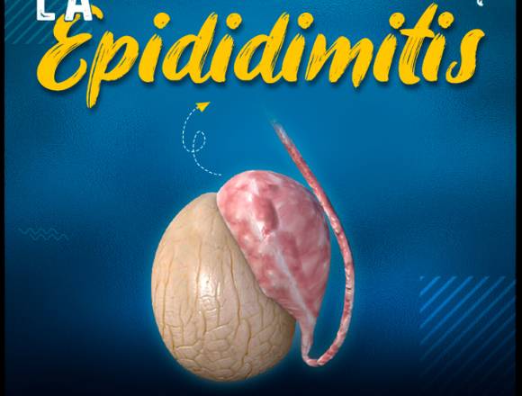 Epididimitis---------