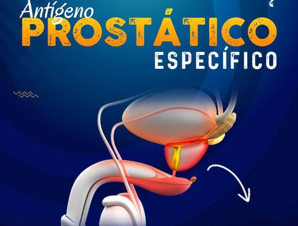 Antígeno Prostático Específico 