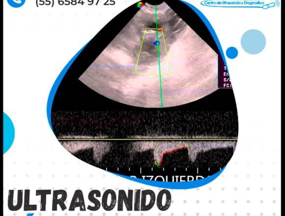 ULTRASONIDO VÍAS URINARIAS