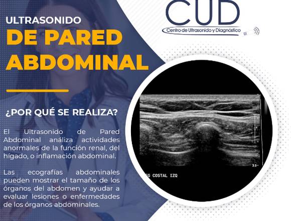 Ultrasonido de Pared Abdominal 