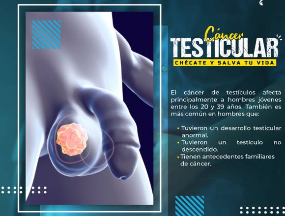 🥵 Cáncer Testícular 🥚🥚