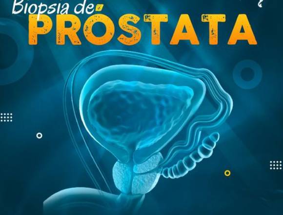 Biopsia de Próstata-----