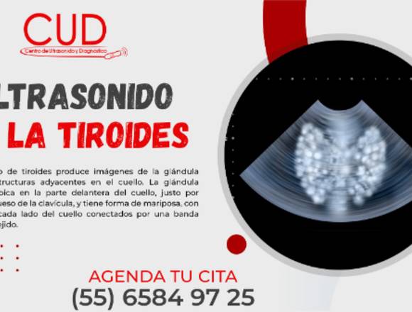 ULTRASONIDO DE LA TIROIDES 