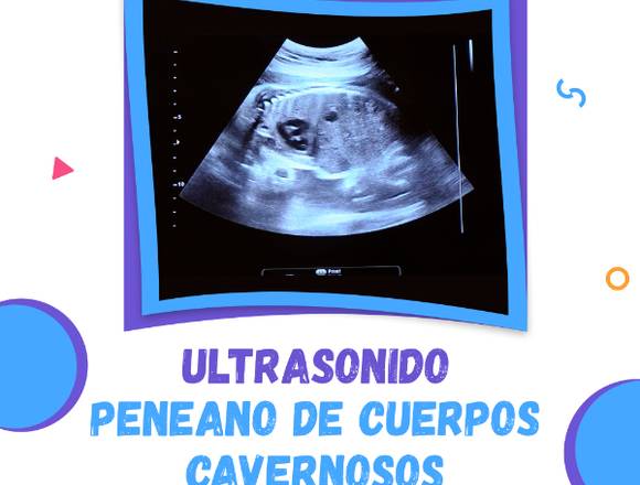 ULTRASONIDO PENEANO DE CUERPOS CAVERNOSOS