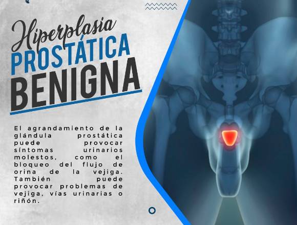 🤕 Hiperplasia Prostática Benigna 🙆‍♂️