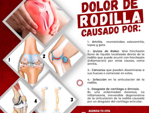 🤒 Dolor de Rodilla 🦵