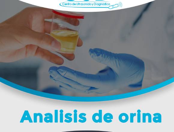 Análisis de orina ,.-.-,.